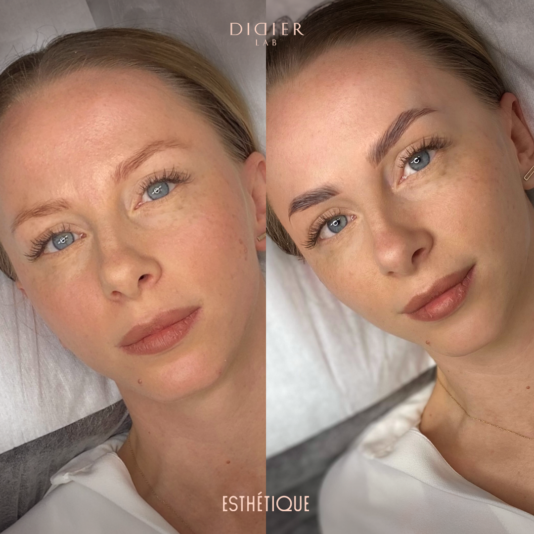 Σετ Lamination Φρυδιών - Didier Lab Esthétique, 3x1τεμ.x1,5 ml