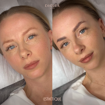 Σετ Lamination Φρυδιών - Didier Lab Esthétique, 3x1τεμ.x1,5 ml